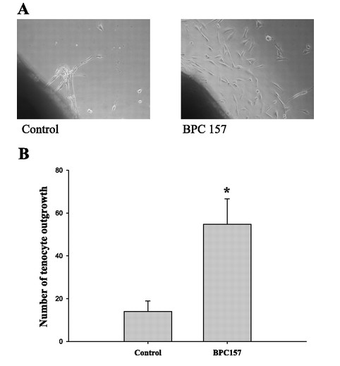 Increase in tendon cell growth and number of tendon fibroblasts with BPC 157