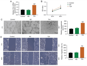 Tβ4 promotes angiogenesis, cell viability, and migration of HUVEC